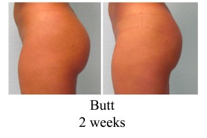 B-A Butt from side HN 2wks
