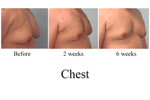 B-A-Chest-45-JD-3-pics