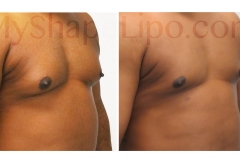 B-A-ONLY-photos-cr-CHEST-SL46W-CHEST-from-45-ED-6-wks