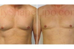 B-A-cr-CHEST-SL46W-CHEST-from-front-RR-6-wks-