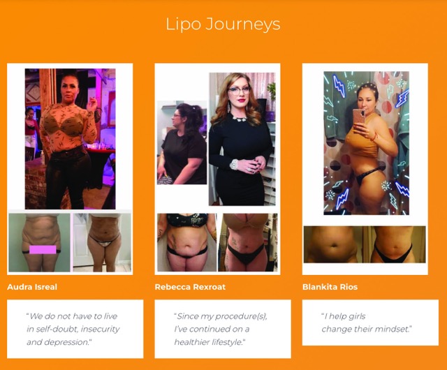 lipo journeys